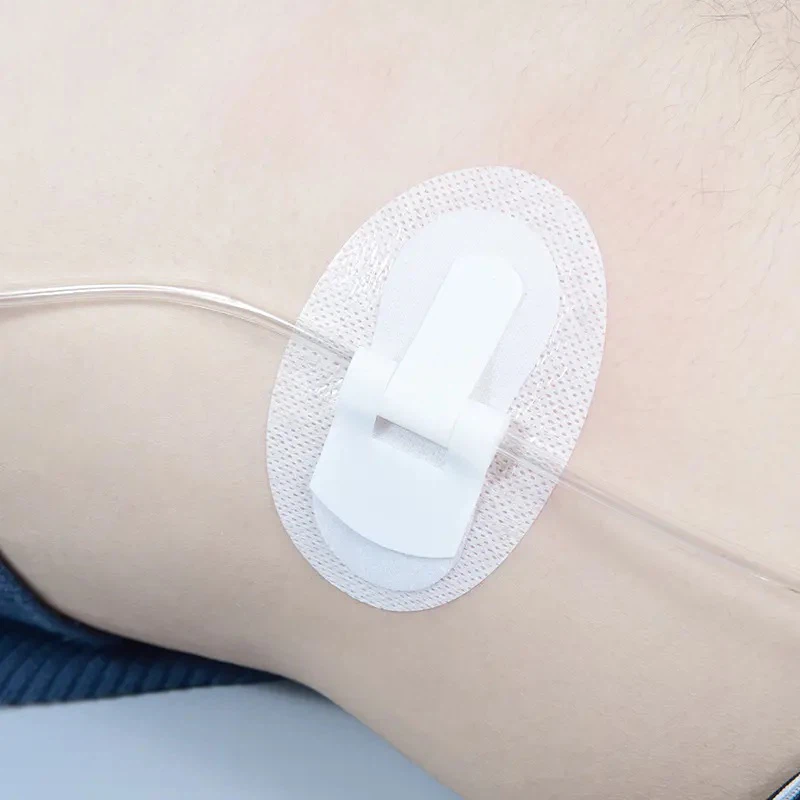 Foley Catheter Stabilization Device